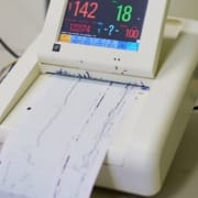 Der-Real-CBD-Blog-Kann-CBD-verbessern-HRV Ecography-Gerät führt einen HRV-Test durch