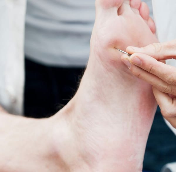 Doctor testing nerve reaction under a patients foot