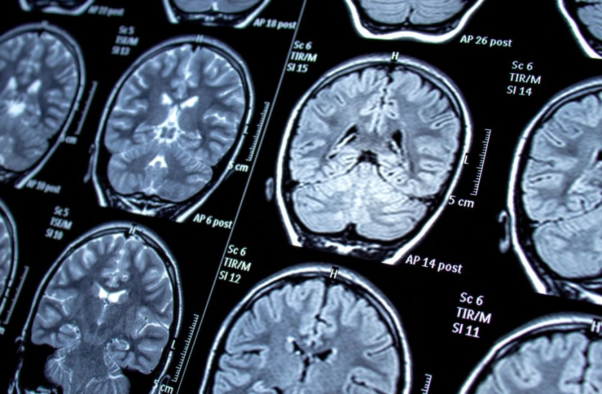 Lots of brain scan pictures