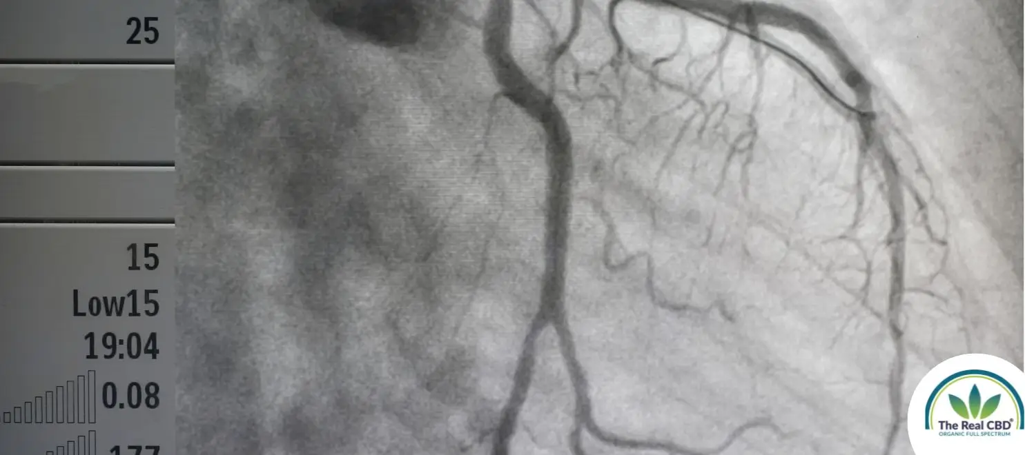 Black and white scan of someone's veins