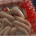 Picture of the large intensine