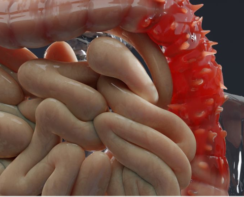 Picture of the large intensine