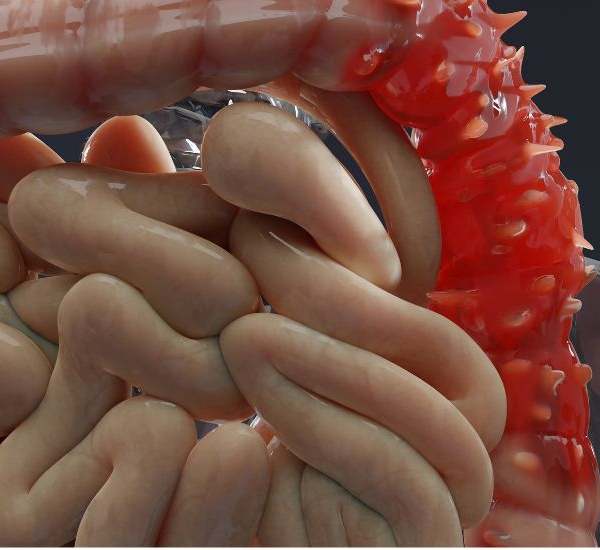 Picture of the large intensine