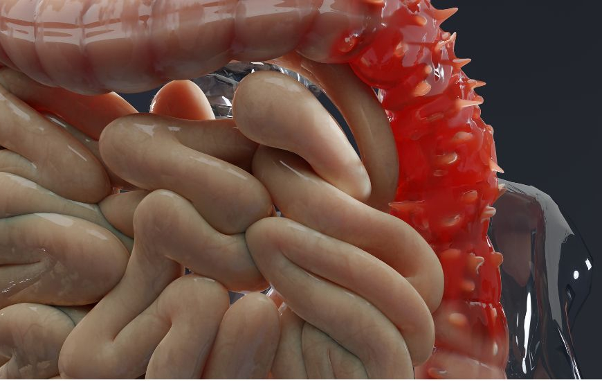 Picture of the large intensine