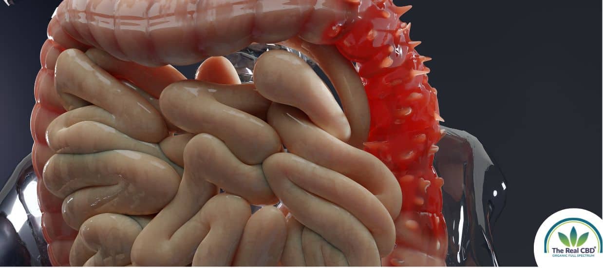 Picture of the large intensine