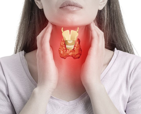 Woman holding her thyroid which seems inflammed