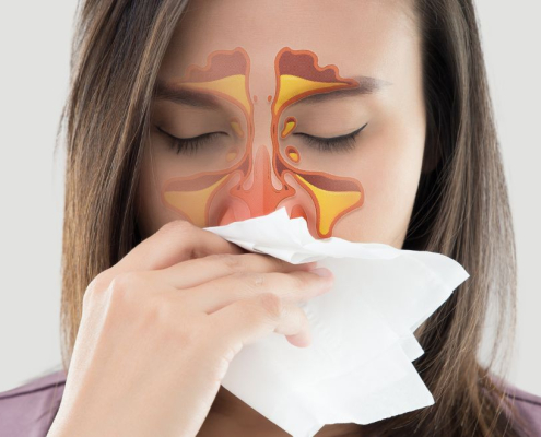 Woman blowing her nose having blocked sinuses