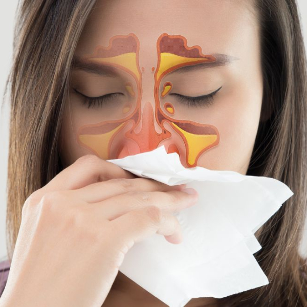 Woman blowing her nose having blocked sinuses
