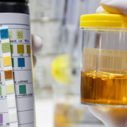 the-real-cbd-blog-Does-CBD-Oil-Change-Urine-Colour Hand holding a urine sample comparing to a colour stick chart