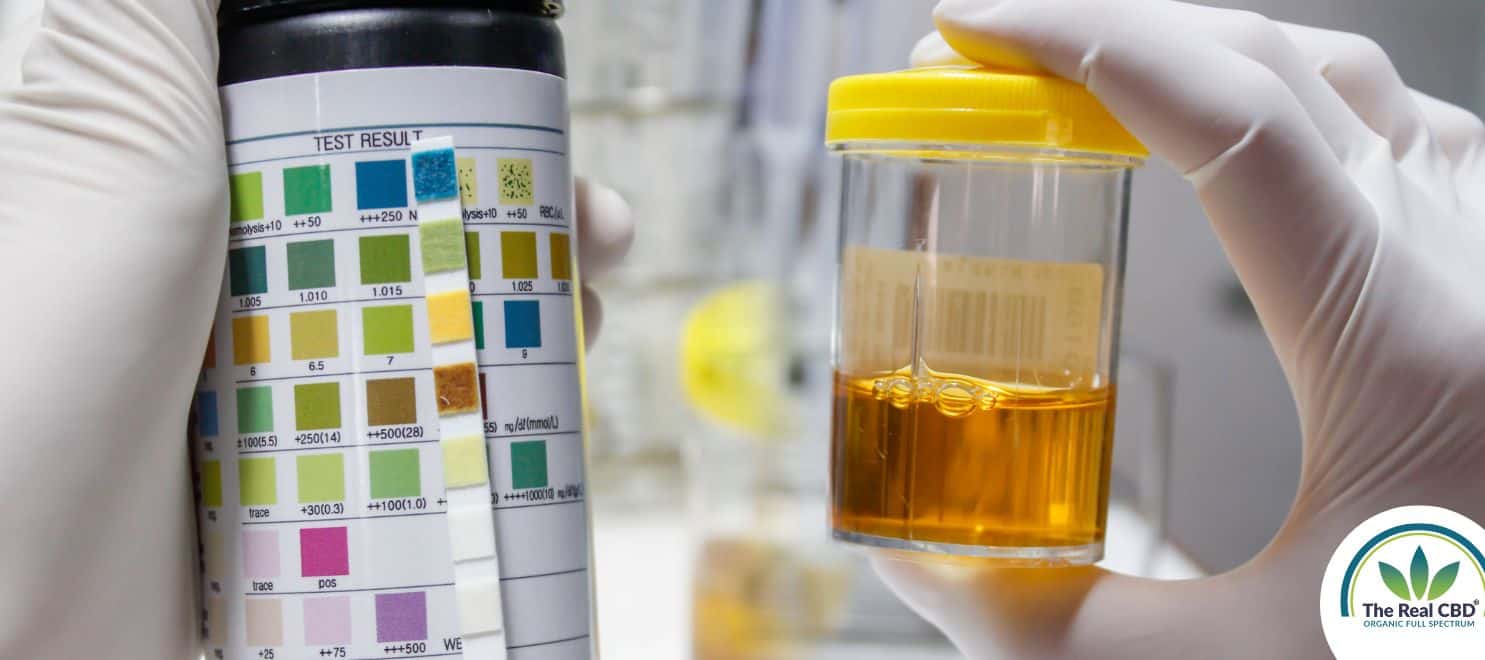 Hand holding a urine sample comparing to a colour stick chart