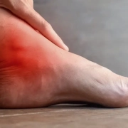 the-real-cbd-blog-cbd-for-FMF Foot with ankle inflammation and pain
