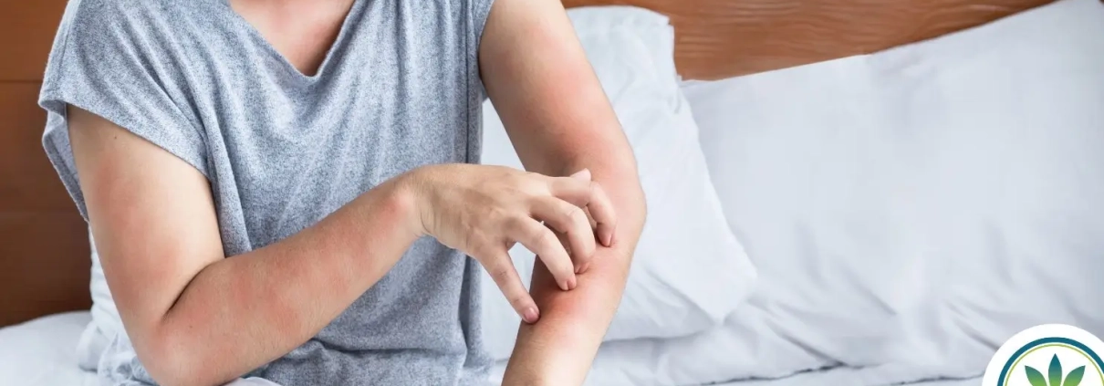 Woman scratching her arm with a red rash