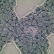 Yeast seen through a microscope