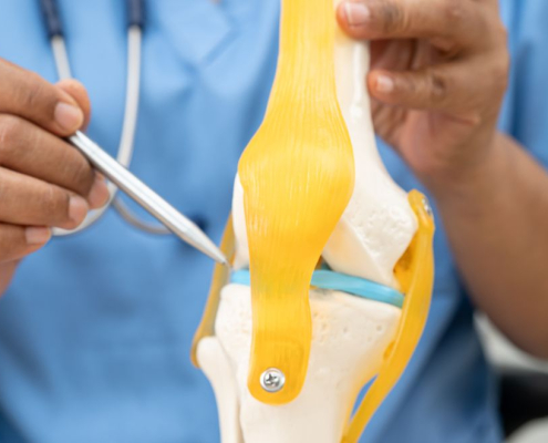 Doctor showing the cartilage of a model knee