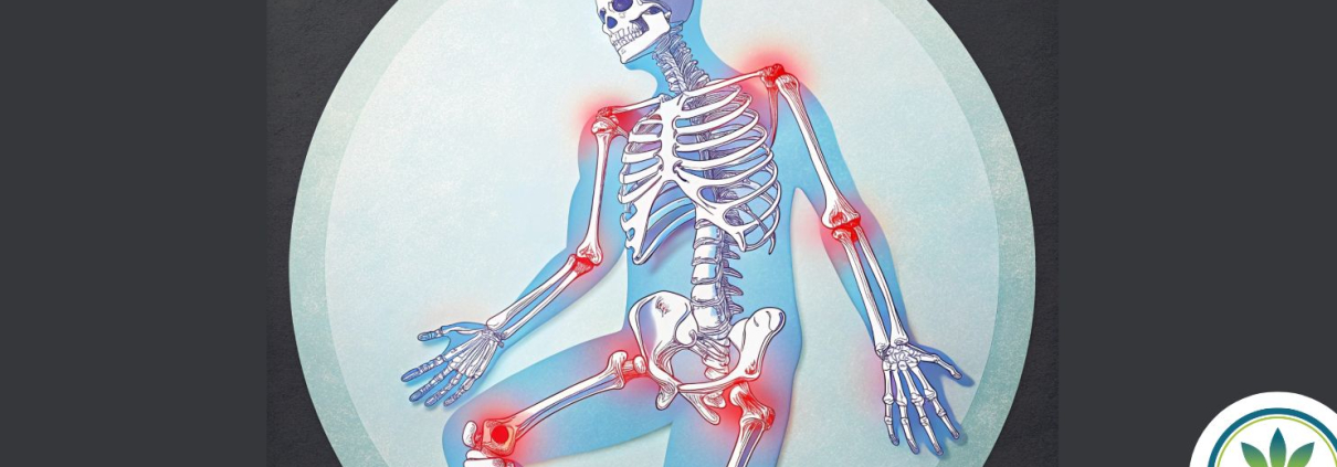 Skeleton with inflamed joints