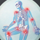 Skeleton with inflamed joints