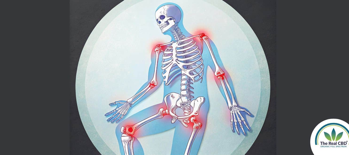 Skeleton with inflamed joints