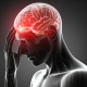 Black and white illustration og a man with a headache