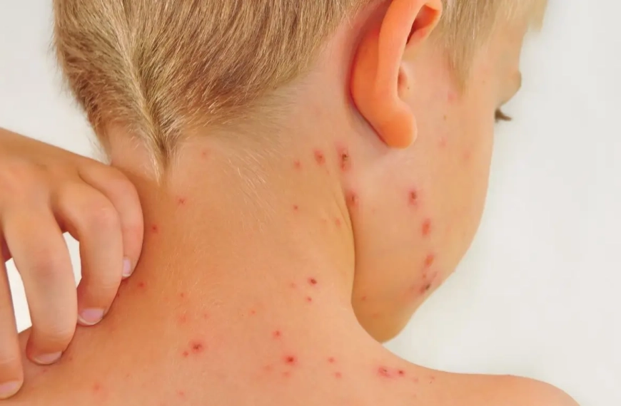 Boy seen from his back and he is itching his red spots